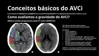 TROMBECTOMIA MECANICA ENFERMAGEM HC UNICAMP.pptx