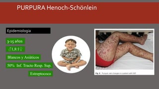 PURPURA Henoch-Schönlein
Epidemiologia
3-15 años
♂1,8:1♀
Blancos y Asiáticos
50% Inf. Tracto Resp. Sup.
Estreptococo
 