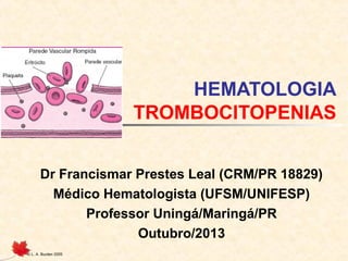 HEMATOLOGIA
TROMBOCITOPENIAS
Dr Francismar Prestes Leal (CRM/PR 18829)
Médico Hematologista (UFSM/UNIFESP)
Professor Uningá/Maringá/PR
Outubro/2013
© L. A. Burden 2005

 