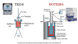 TEG® ROTEM®
International Journal of Perioperative Ultrasound and Applied Technologies, January- April 2012;1(1):25-29
 