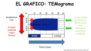 EL GRAFICO: TEMograma
Lineas verdes
son marcas a
40 mm, para
una
estimacion
visual de la
amplitud.
Amplitud en
mm
A mayor
amplitud
mayor
firmeza
https://www.haemoview.com.au/rotem-analysis.html
 