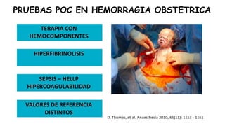 PRUEBAS POC EN HEMORRAGIA OBSTETRICA
 