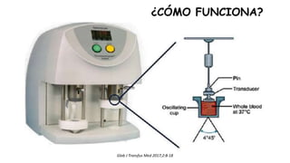 Glob J Transfus Med 2017;2:8-18
¿CÓMO FUNCIONA?
 
