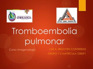 Tromboembolia
     pulmonar
Curso: Imagenología    LUIS A. IRIGOYEN CONTRERAS
                      GRUPO 7-2 MATRÍCULA 238091
 