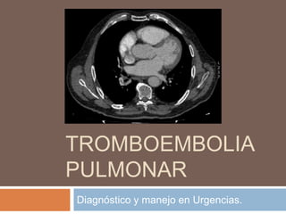TROMBOEMBOLIA
PULMONAR
Diagnóstico y manejo en Urgencias.
 