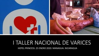 I TALLER NACIONAL DE VARICES
HOTEL PRINCESS. 25 ENERO 2020. MANAGUA. NICARAGUA
 