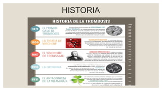 HISTORIA
 