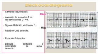 ⦁ inversión de las ondas T en
las derivaciones V1-V4.
⦁ Rotación P derecha.
o
completo
de rama
⦁ Bloqueo
incompleto
derecha.
⦁ Cambios secuenciales.
Alteraciones secundarias a
⦁ Elevación de la presión
pulmonar.
⦁ Signos dilatación ventricular D.
⦁ Hipoxemia.
⦁ Rotación QRS derecha.
⦁ Isquemia miocárdica.
⦁ Dilatación VD.
 