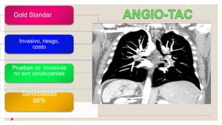 Gold Standar
Invasivo, riesgo,
costo
Pruebas no invasivas
no son concluyentes
Sensibilidad
98%
 