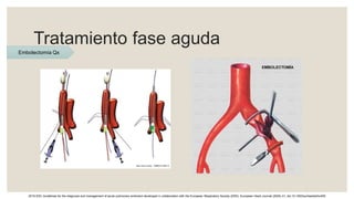 Tratamiento fase aguda
2019 ESC Guidelines for the diagnosis and management of acute pulmonary embolism developed in collaboration with the European Respiratory Society (ERS). European Heart Journal (2020) 41, doi:10.1093/eurheartj/ehz405
Embolectomía Qx
 