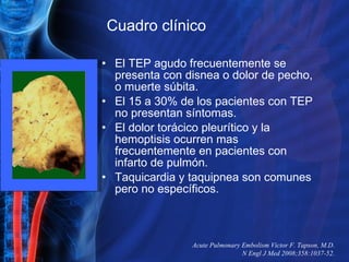 El TEP agudo frecuentemente se presenta con disnea o dolor de pecho, o muerte súbita. El 15 a 30% de los pacientes con TEP no presentan síntomas. El dolor torácico pleurítico y la hemoptisis ocurren mas frecuentemente en pacientes con infarto de pulmón. Taquicardia y taquipnea son comunes pero no específicos.  Acute Pulmonary Embolism Victor F. Tapson, M.D. N Engl J Med 2008;358:1037-52. Cuadro clínico  