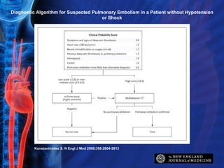 Diagnostic Algorithm for Suspected Pulmonary Embolism in a Patient without Hypotension or Shock Konstantinides S. N Engl J Med 2008;359:2804-2813 