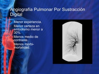 Angiografía Pulmonar Por Sustracción Digital Menor experiencia. Menor certeza en embolismo menor a 30%. Menos medio de contraste. Menos morbi-mortalidad. 