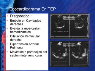 Ecocardiograma En TEP Diagnóstico : Embolo en Cavidades derechas Evalúa la repercusión hemodinamica Dilatación Ventricular derecha Hipertensión Arterial Pulmonar Movimiento paradojico del septum interventricular 
