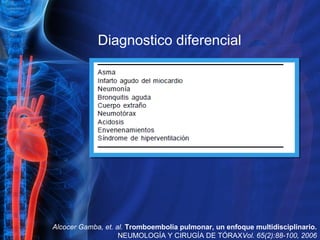 Diagnostico diferencial Alcocer Gamba, et. al.  Tromboembolia pulmonar, un enfoque multidisciplinario.  NEUMOLOGÍA Y CIRUGÍA DE TÓRAX Vol. 65(2):88-100, 2006 