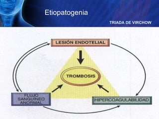 Etiopatogenia TRIADA DE VIRCHOW 