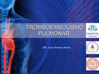 TROMBOEMBOLISMO   PULMONAR DR. Juan Álvarez Arana 