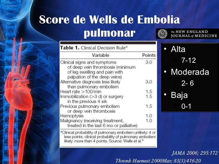 Tromboembolismo pulmonar