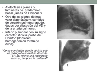 • Atelectasias planas o
  laminares de predominio
  basal (líneas de Fleiscner)
• Otro de los signos de más
  valor diagnóstico y, cambios
  de corazón pulmonar agudo,
  dados por dilatación del VD y
  de la arteria pulmonar.
• Infarto pulmonar con su signo
  característico la joroba de
  Hamton (densidad
  homogénea en forma de
  cuña).

“Como conclusión, puede decirse que
  una radiografía normal no descarta
     TEP, así mismo una radiografía
      anormal, tampoco lo confirma!”
 