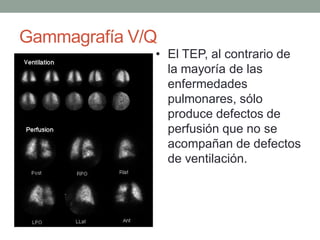 Gammagrafía V/Q
              • El TEP, al contrario de
                la mayoría de las
                enfermedades
                pulmonares, sólo
                produce defectos de
                perfusión que no se
                acompañan de defectos
                de ventilación.
 