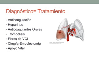Diagnóstico= Tratamiento
• Anticoagulación
• Heparinas
• Anticoagulantes Orales
• Trombólisis
• Filtros de VCI
• Cirugía-Embolectomía
• Apoyo Vital
 