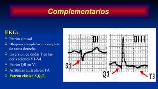 EKG:
 Patrón sinusal
 Bloqueo completo o incompleto
de rama derecha
 Inversion de ondas T en las
derivaciones V1-V4
 Patrón QR en V1
 Arritmias auriculares: FA
 Patrón clásico S1Q3T3
Complementarios
 
