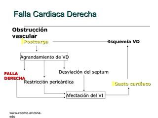 Falla Cardiaca Derecha  Obstrucción vascular Postcarga Agrandamiento de VD FALLA DERECHA Desviación del septum Restricción pericárdica Afectación del VI Gasto cardíaco Isquemia VD www.reeme.arizona.edu 