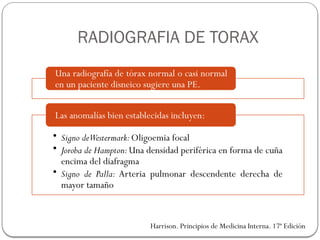RADIOGRAFIA DE TORAX
Una radiografía de tórax normal o casi normal
en un paciente disneico sugiere una PE.
• Signo deWestermark:Oligoemia focal
• Joroba de Hampton:Una densidad periférica en forma de cuña
encima del diafragma
• Signo de Palla: Arteria pulmonar descendente derecha de
mayor tamaño
Las anomalías bien establecidas incluyen:
Harrison. Principios de Medicina Interna. 17ª Edición
 