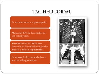 TAC HELICOIDAL
Es una alternativa a la gammagrafía.
Menos del 10% de los estudios no
son concluyentes.
Sensibilidad del 75-100% para
detección de los émbolos en grandes
arterias y arterias segmentarias.
Es incapaz de detectar émbolos en
arterias subsegmentarias.
 