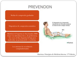PREVENCION
Medias de compresión graduadas
Dispositivos de compresión neumática
Minidosis de heparina no fraccionada (5000
U por vía subcutánea dos o, de preferencia,
tres veces al día), heparina de bajo peso
molecular, un pentasacárido o warfarina.
Los sistemas de recordatorio
computadorizados
Harrison. Principios de Medicina Interna. 17ª Edición
 