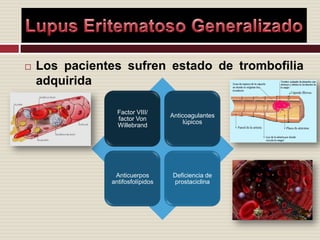 Los pacientes sufren estado de trombofilia adquiridaLupus Eritematoso Generalizado
