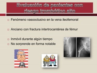 Interfiere con la dilución de los factores activados en el flujo sanguíneo Hipoxia y acidosis CoagulaciónPosoperatorio