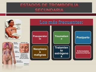 ESTADOS DE TROMBOFILIA SECUNDARIALos más frecuentes: