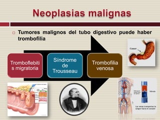 Tumores malignos del tubo digestivo puede haber trombofiliaNeoplasias malignas