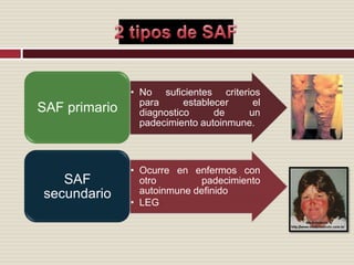 2 tipos de SAF