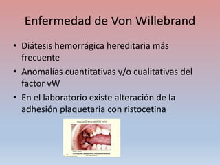 Enfermedad de Von Willebrand
• Diátesis hemorrágica hereditaria más
frecuente
• Anomalías cuantitativas y/o cualitativas del
factor vW
• En el laboratorio existe alteración de la
adhesión plaquetaria con ristocetina
 