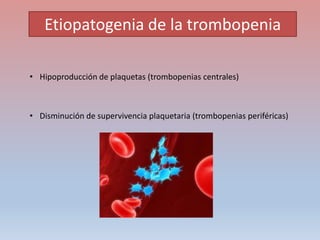 Etiopatogenia de la trombopenia
• Hipoproducción de plaquetas (trombopenias centrales)
• Disminución de supervivencia plaq...