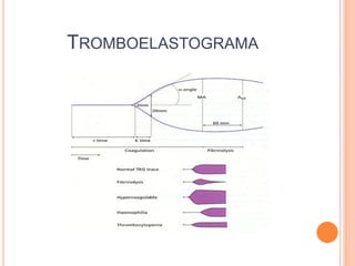 TROMBOELASTOGRAMA
 