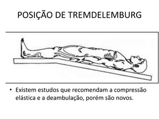 POSIÇÃO DE TREMDELEMBURG




• Existem estudos que recomendam a compressão
  elástica e a deambulação, porém são novos.
 