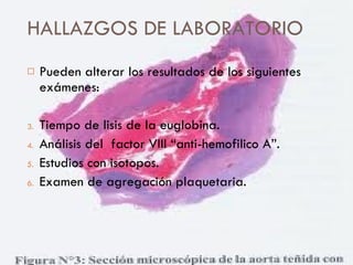 HALLAZGOS DE LABORATORIO Pueden alterar los resultados de los siguientes exámenes: Tiempo de lisis de la euglobina. Análisis del  factor VIII “anti-hemofilico A”. Estudios con isotopos. Examen de agregación plaquetaria. 
