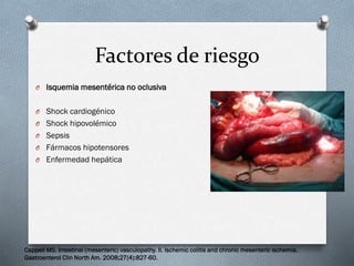 Factores de riesgo
O Isquemia mesentérica no oclusiva
O Shock cardiogénico
O Shock hipovolémico
O Sepsis
O Fármacos hipotensores
O Enfermedad hepática

Cappell MS. Intestinal (mesenteric) vasculopathy. II. Ischemic colitis and chronic mesenteric ischemia.
Gastroenterol Clin North Am. 2008;27(4):827-60.

 