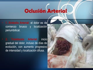 Oclusión Arterial
• 1. Embolia Arterial: el dolor es de
comienzo brusco y localización
periumbilical.
• 2. Trombosis Arterial: inicio
gradual del dolor, incluso de días de
evolución, con aumento progresivo
de intensidad y localización difusa.

 