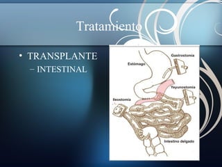 Tratamiento
• TRANSPLANTE
– INTESTINAL

 