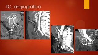 TC- angiográfica
 