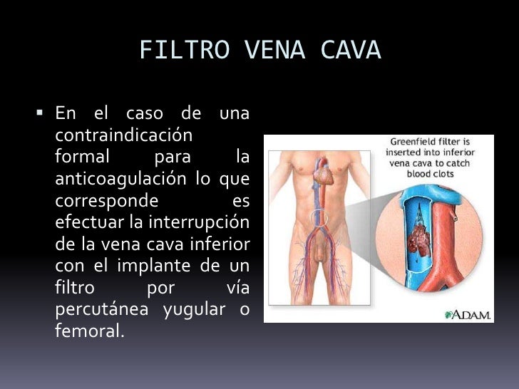 La desaparición láser de las venas en los pies en cheboksarah