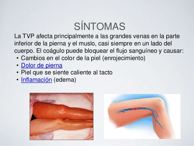 Los nombres de las bacterias de los parásitos