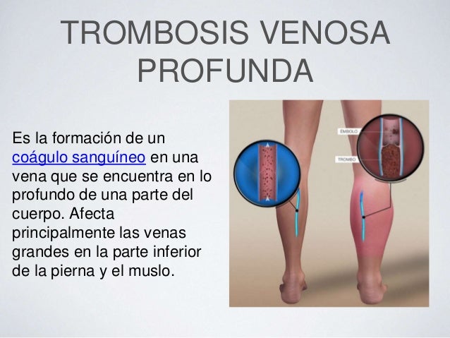 La psicología en ayda de que adelgaza