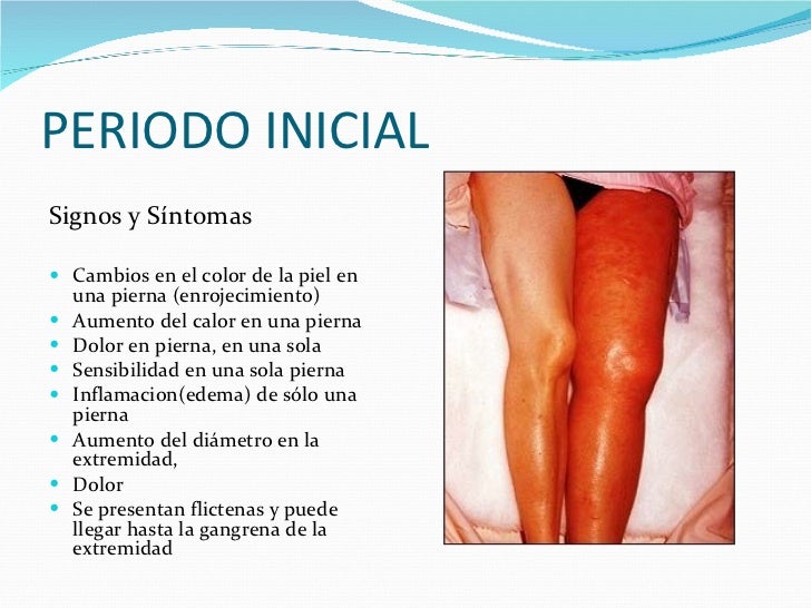 Las tromboflebitis de las extremidades superiores