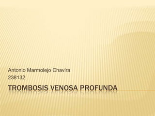 Antonio Marmolejo Chavira
238132

TROMBOSIS VENOSA PROFUNDA
 