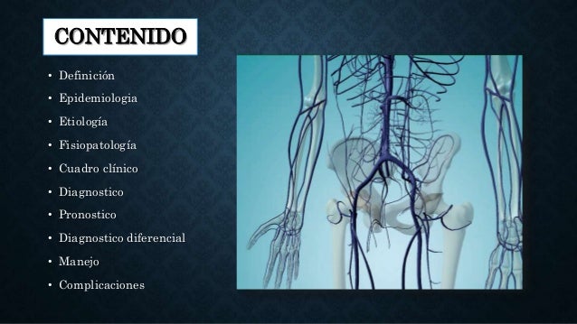 Trombosis Venosa Profunda